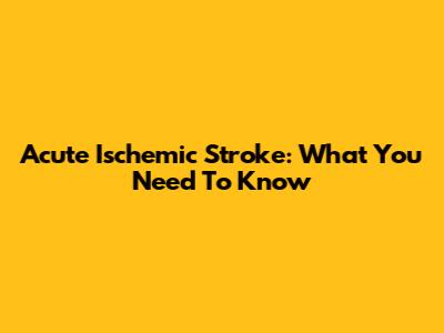 Acute Ischemic Stroke: What You Need To Know