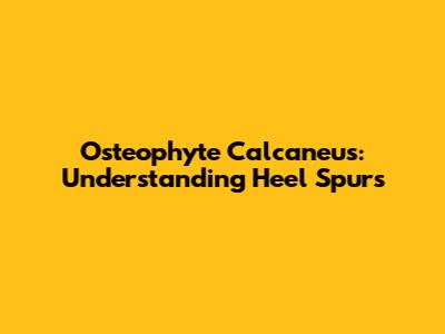 Osteophyte Calcaneus: Understanding Heel Spurs
